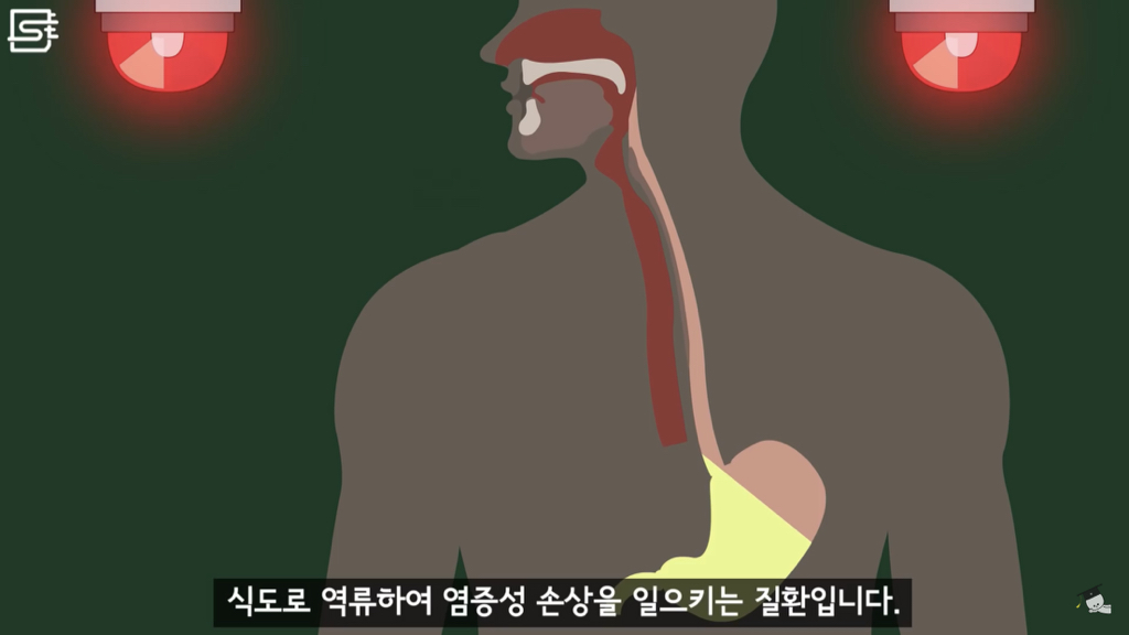 밥 먹고 바로 누우면 정말 살이 찔까? | 인스티즈
