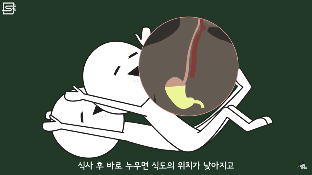 밥 먹고 바로 누우면 정말 살이 찔까? | 인스티즈