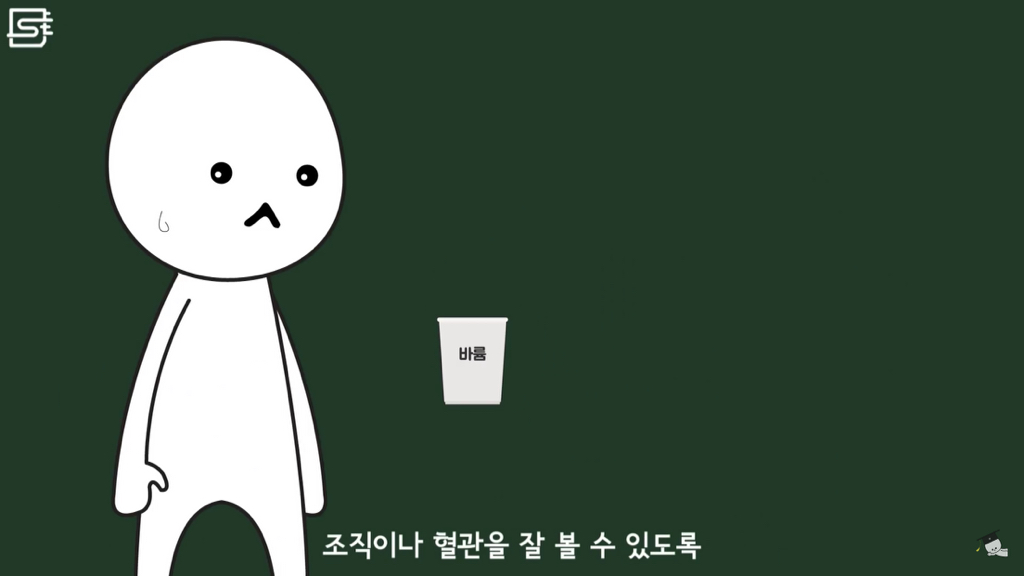밥 먹고 바로 누우면 정말 살이 찔까? | 인스티즈