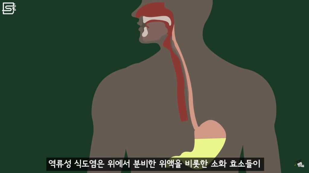 밥 먹고 바로 누우면 정말 살이 찔까? | 인스티즈