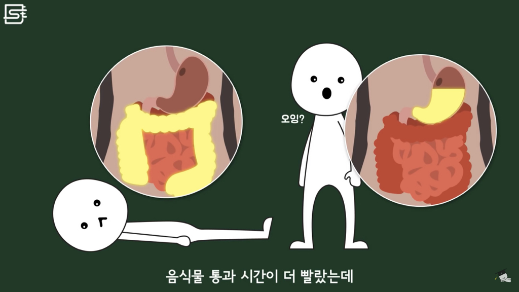 밥 먹고 바로 누우면 정말 살이 찔까? | 인스티즈