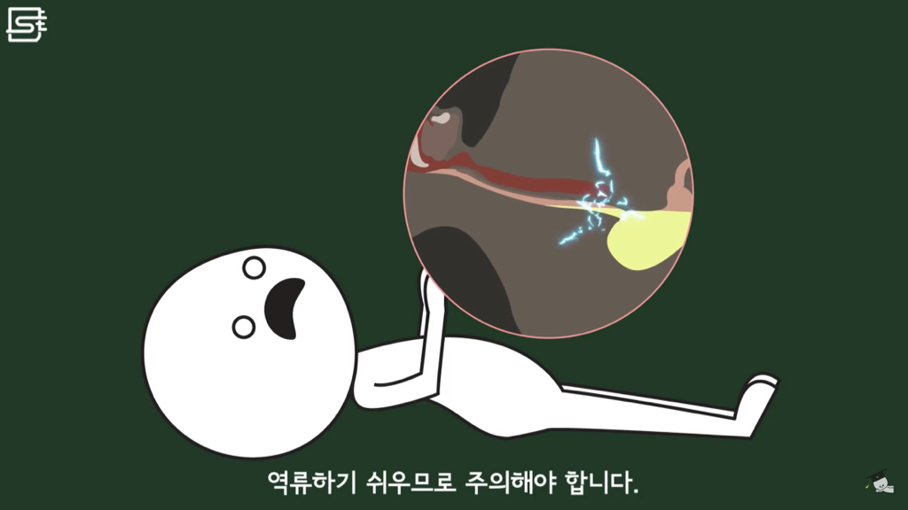 밥 먹고 바로 누우면 정말 살이 찔까? | 인스티즈