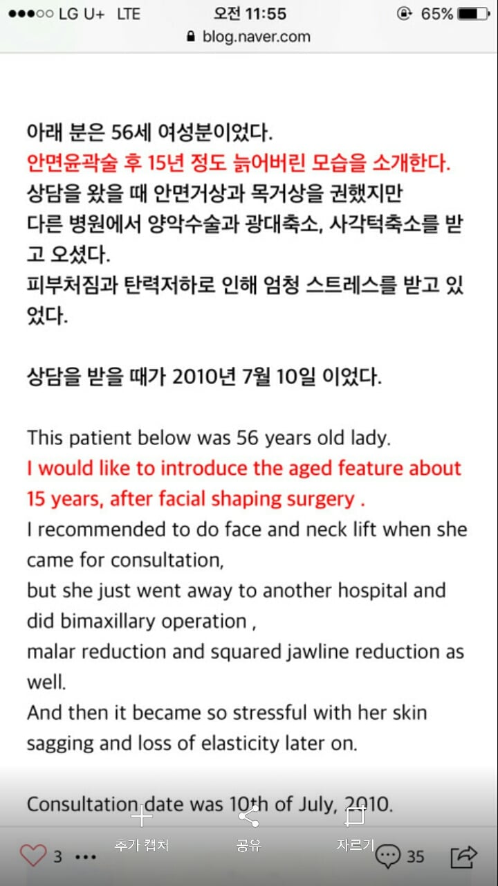 의사가 말해주는 안면윤곽수술 7개월 후 살처짐 | 인스티즈