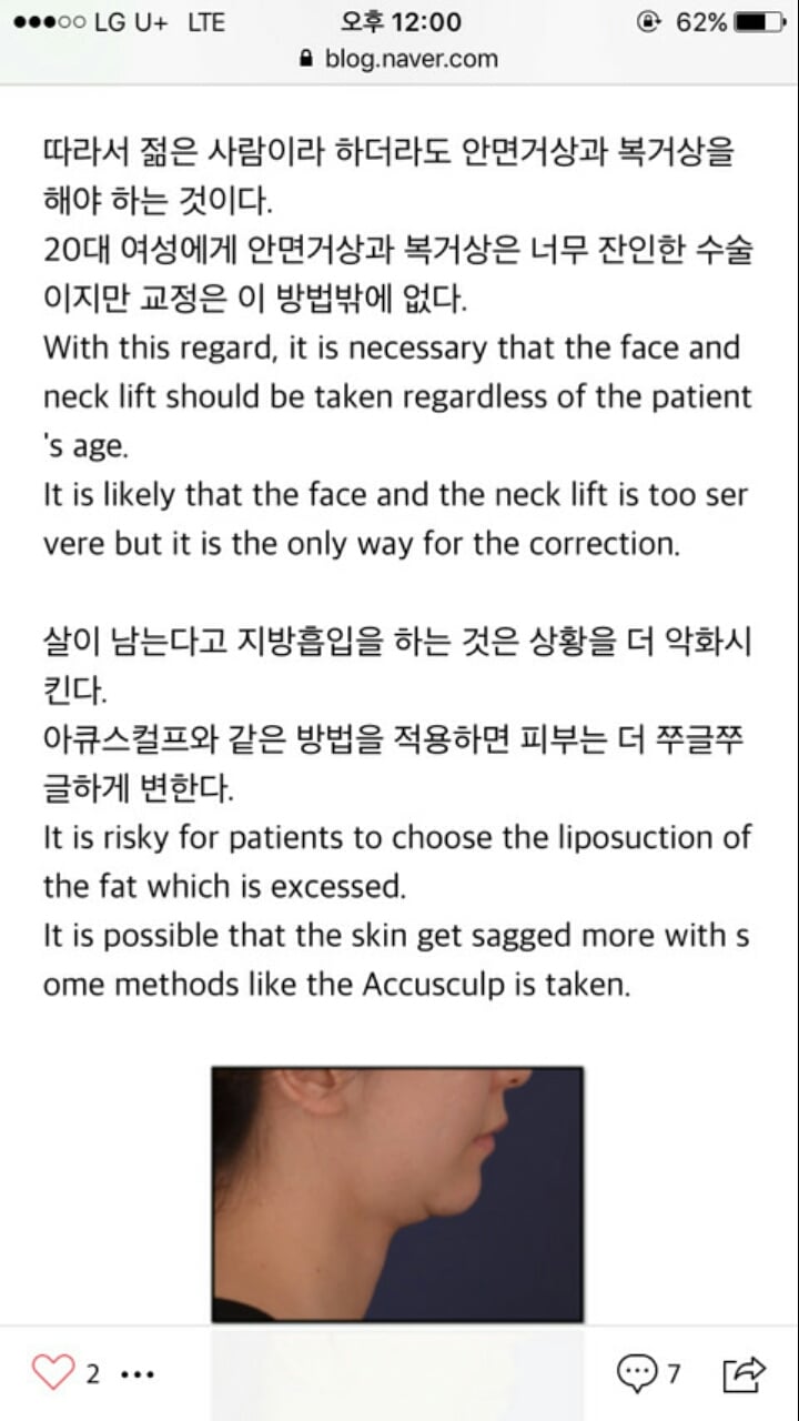 의사가 말해주는 안면윤곽수술 7개월 후 살처짐 | 인스티즈
