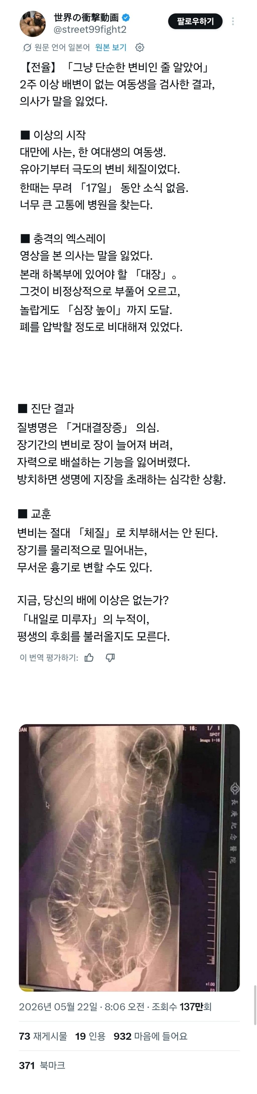 변비가 무서운 이유.jpg | 인스티즈