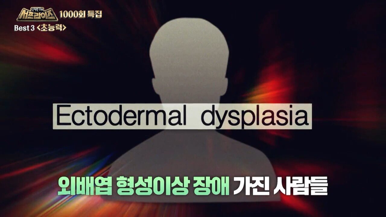 서프라이즈 선정 초능력자 1위 "인간 배터리" | 인스티즈