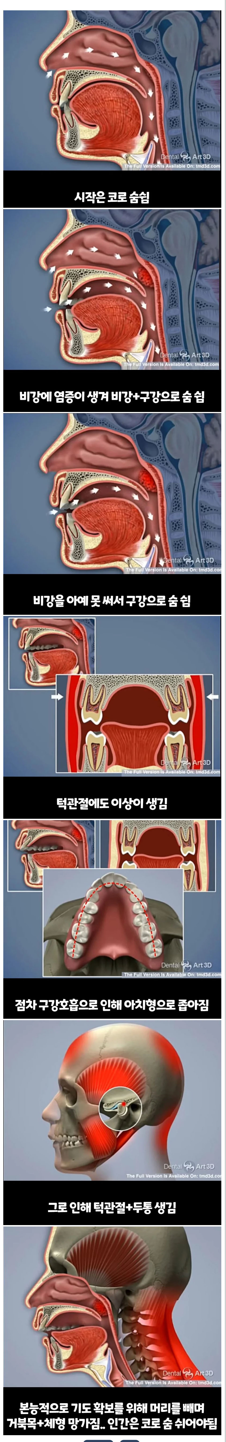 비염의 무서움.jpg | 인스티즈