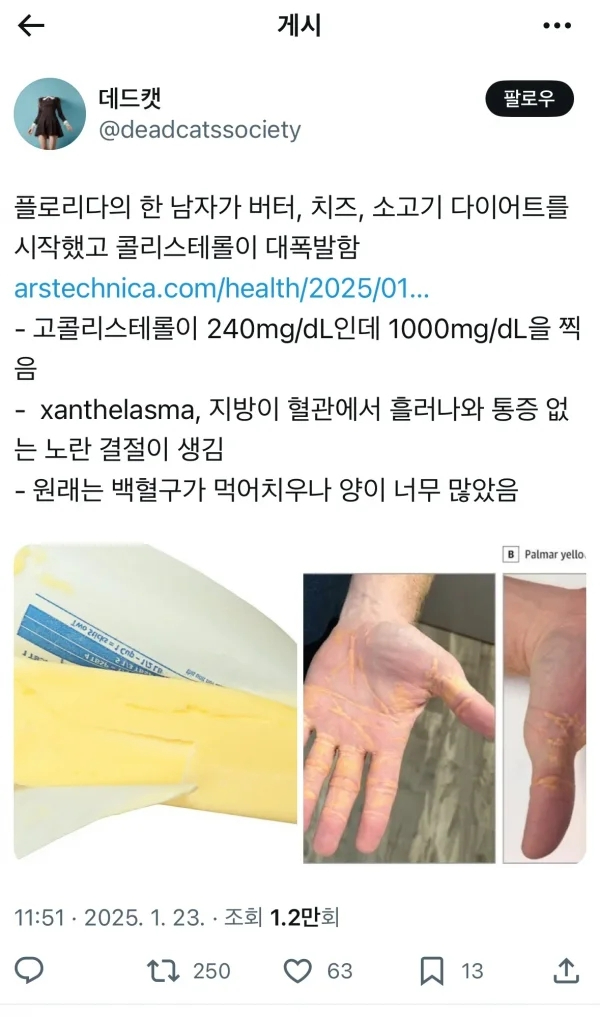 저탄고지에 진심이었던 미국남자 | 인스티즈