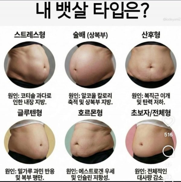 내 뱃살 타입은?.jpg | 인스티즈