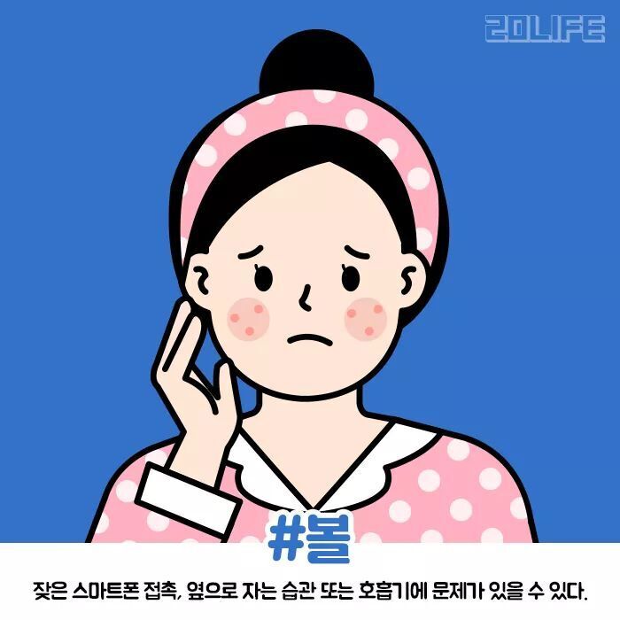 얼굴 부위별 여드름 나는 원인.jpg | 인스티즈