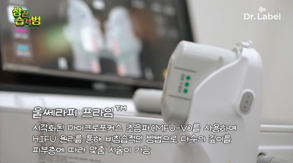 요새 피부과에서 제일 많이 한다는 시술.jpg | 인스티즈