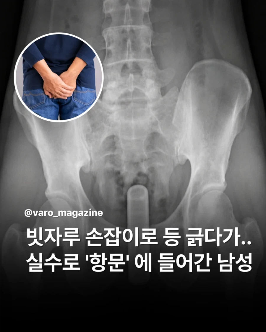 샴푸통을 바닥에 두면 위험한 이유 | 인스티즈