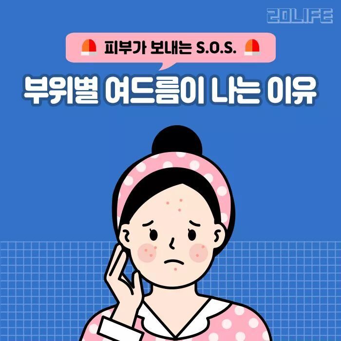 얼굴 부위별 여드름 나는 원인.jpg | 인스티즈