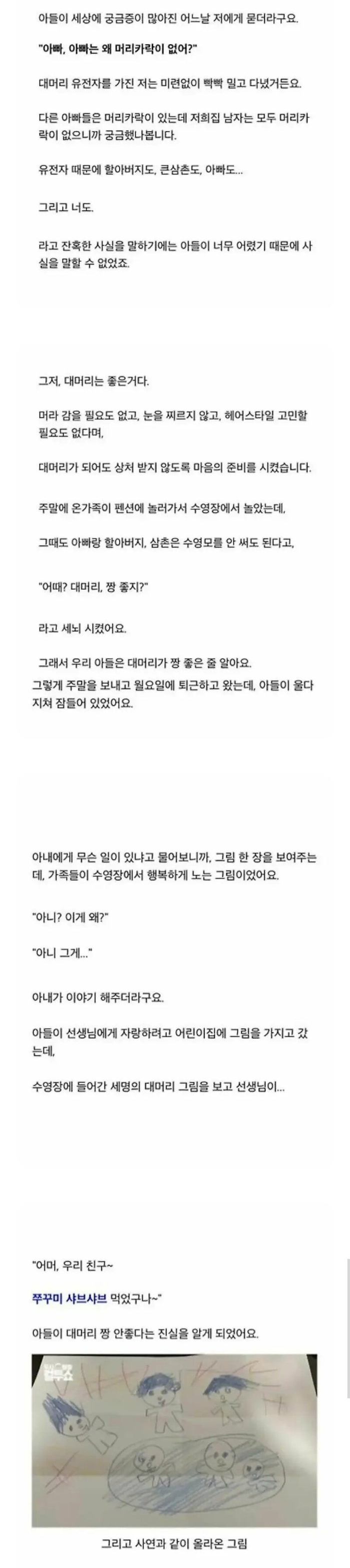 대머리는 좋은거라고 가스라이팅한 결과 | 인스티즈