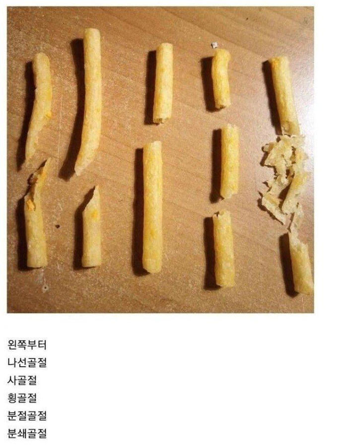 과자로 알아보는 골절의 종류 | 인스티즈