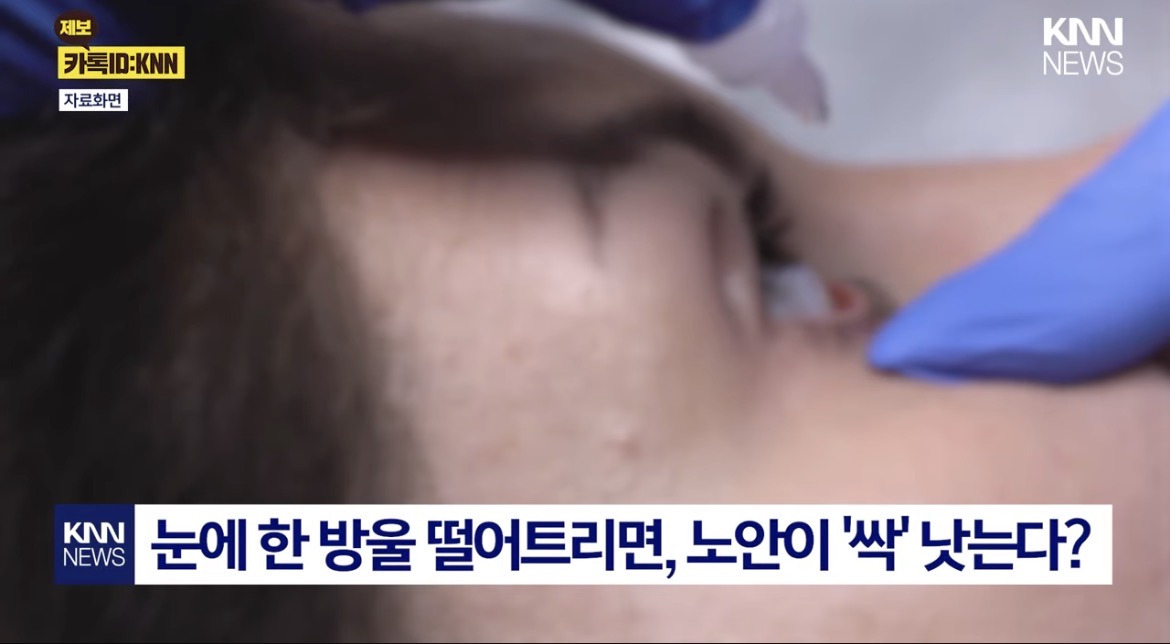 한 방울 넣으면 노안 낫는 안약? FDA 승인까지 받은 '역대급 안약 올해안에 출시 | 인스티즈