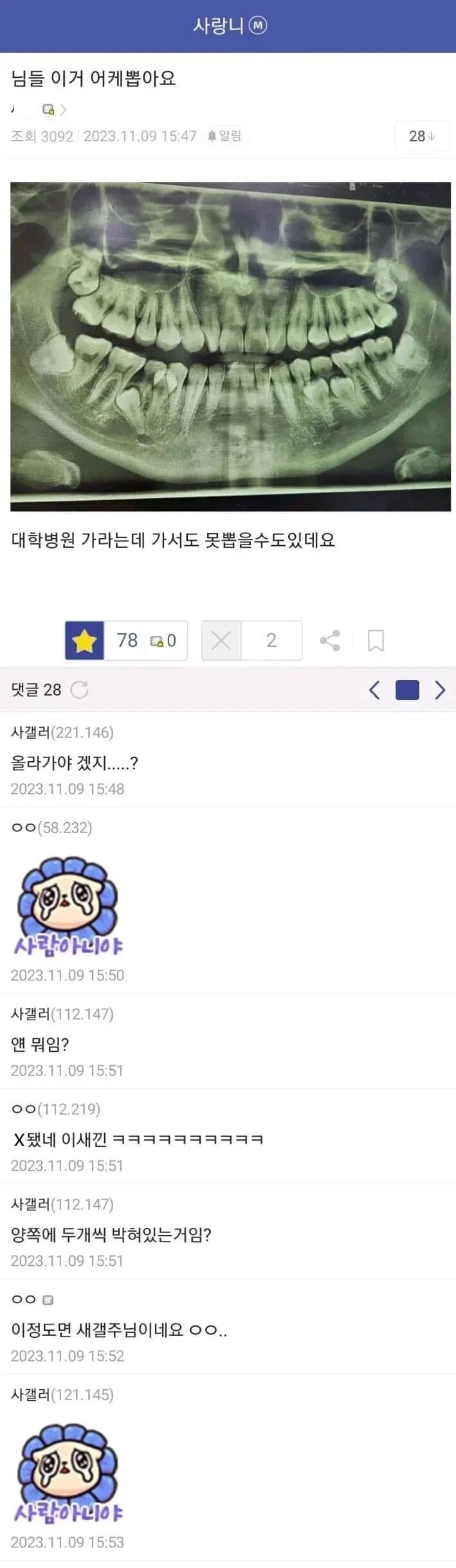 사랑니 레전드 | 인스티즈