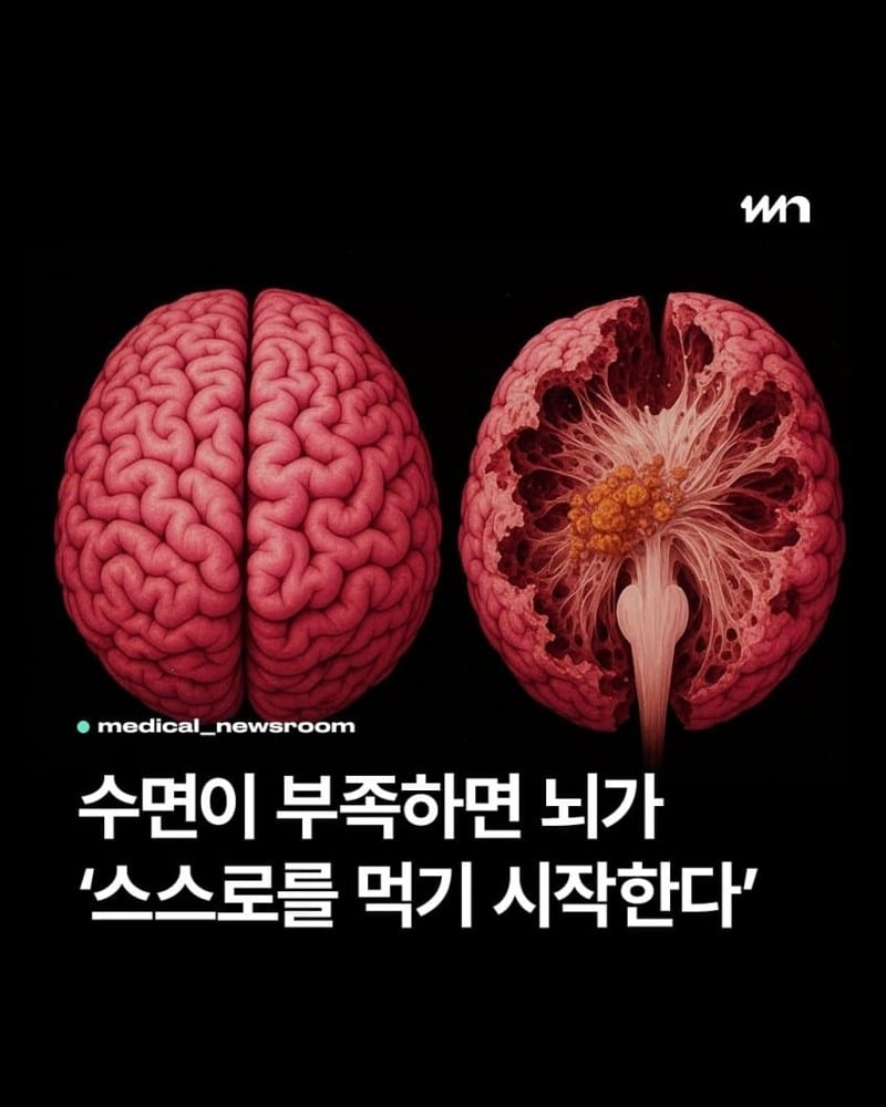 잠을 부족하지 않게 자야하는 이유 | 인스티즈