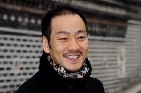모발이식 후 초대박난 배우 | 인스티즈