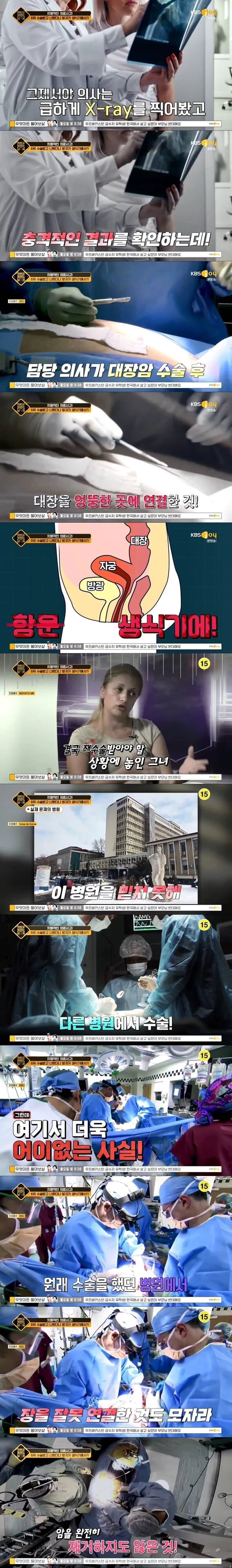 생식기에서 방귀와 대변이 나오게 된 사연 | 인스티즈