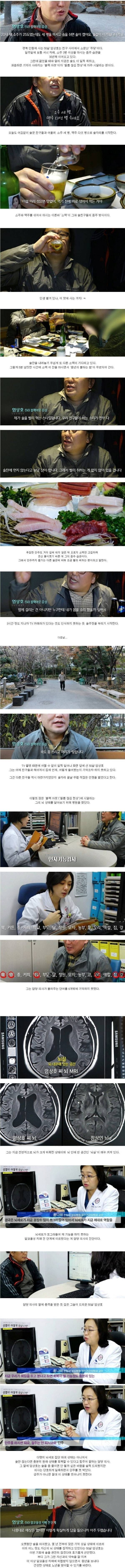 50대 애주가의 뇌 상태 | 인스티즈
