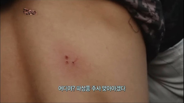 파상풍 주사 맞아야되는 사극 스턴트맨 | 인스티즈