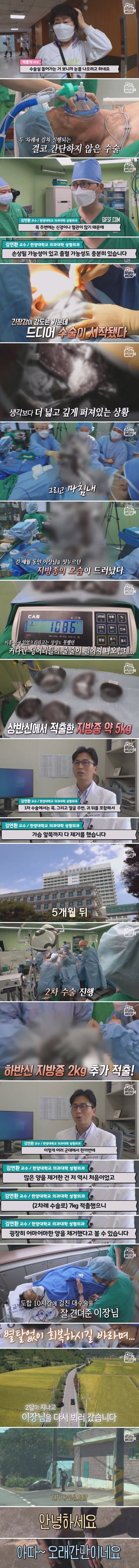 29년 만에 지방종 7kg 없앤 남자 | 인스티즈