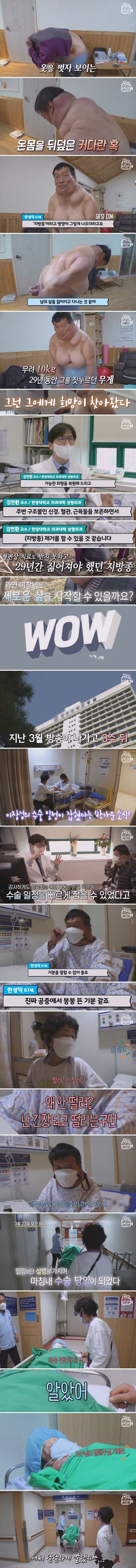 29년 만에 지방종 7kg 없앤 남자 | 인스티즈