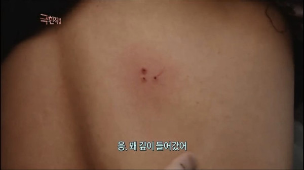 파상풍 주사 맞아야되는 사극 스턴트맨 | 인스티즈