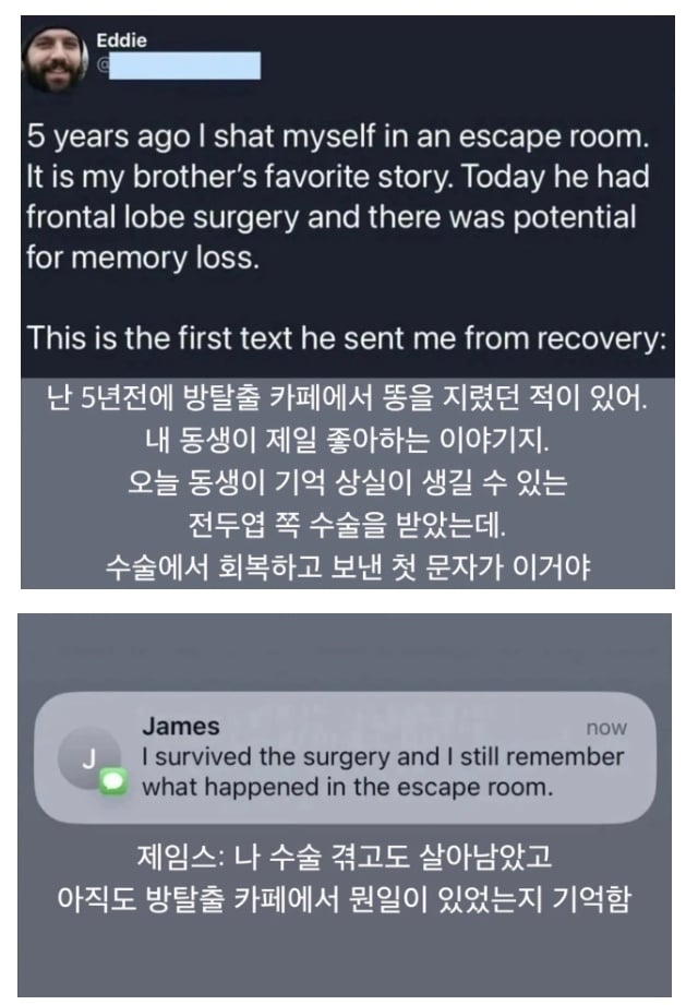 위험한 뇌수술을 마친 동생이 보낸 문자 | 인스티즈