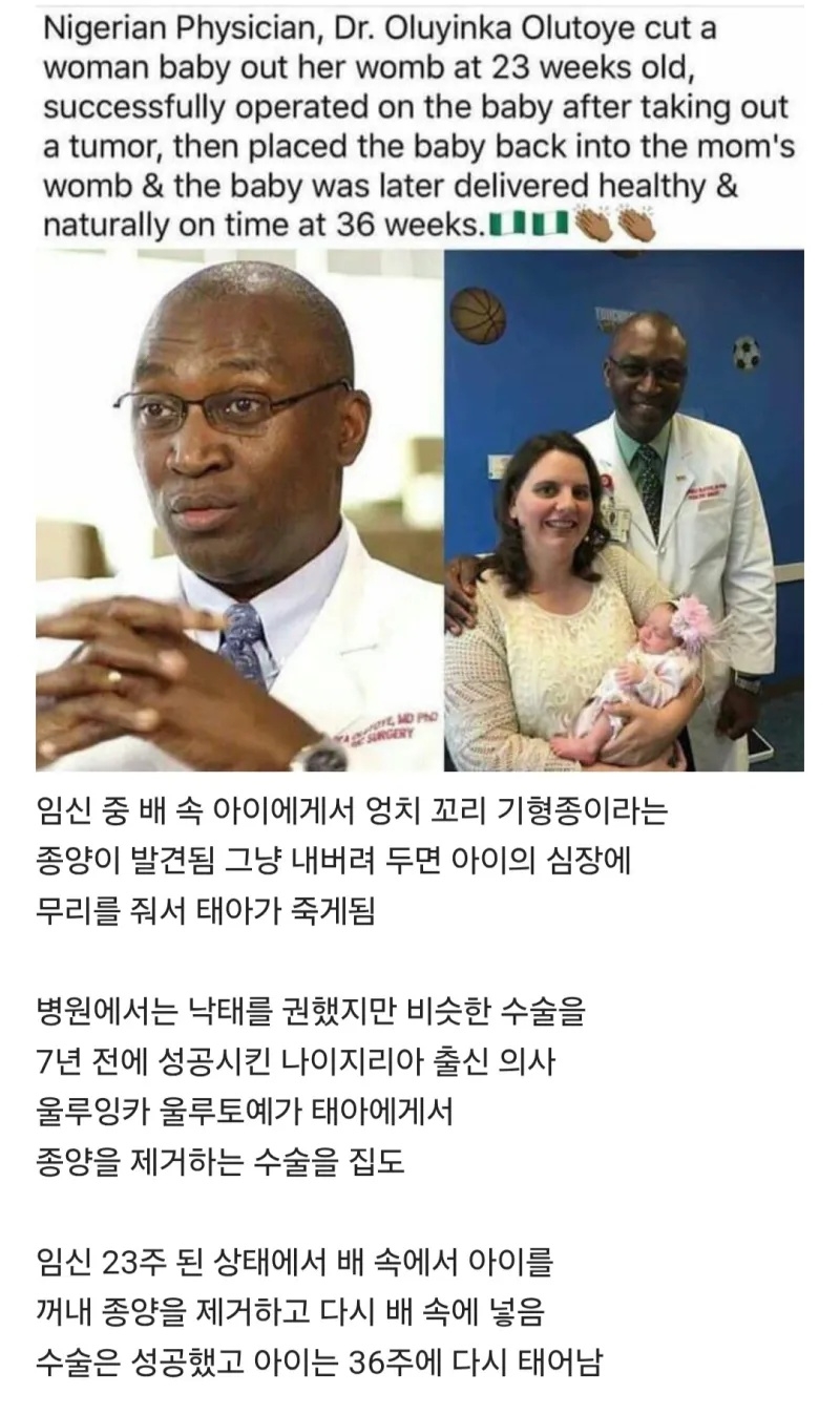 엄마 배 속에서 두 번 태어난 아기 | 인스티즈