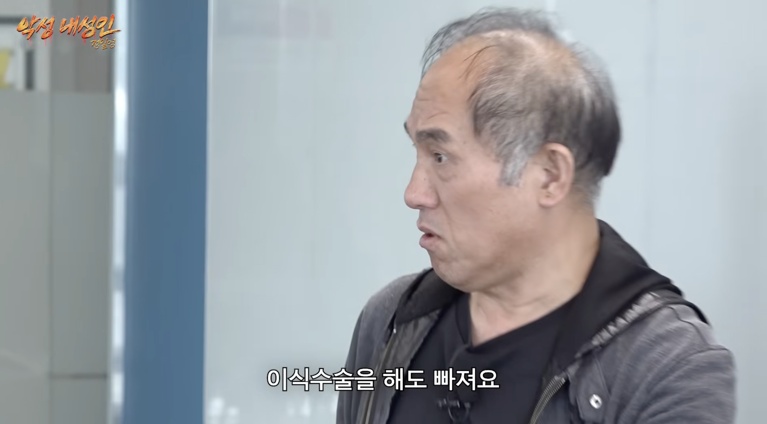 머리 심어도 자꾸 빠진다는 대머리 연예인 지망생.jpg | 인스티즈