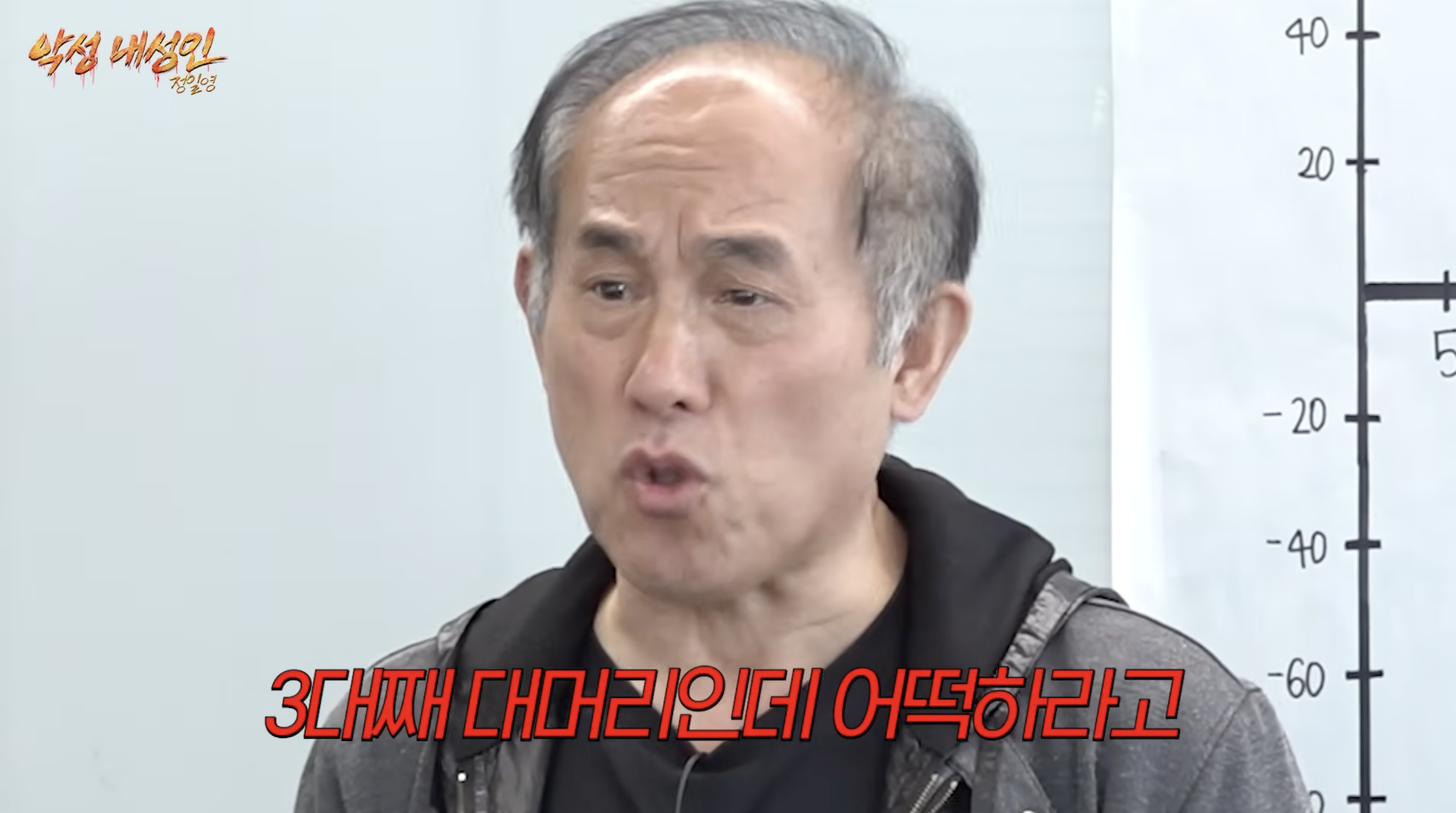 머리 심어도 자꾸 빠진다는 대머리 연예인 지망생.jpg | 인스티즈
