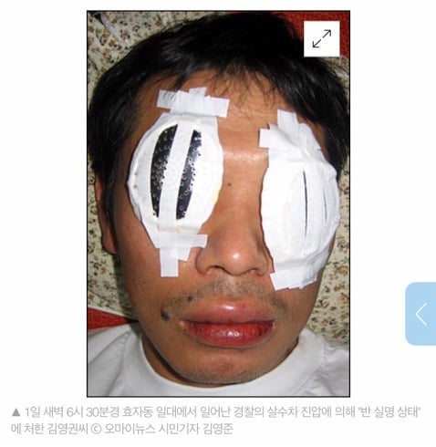 요즘 사람들은 잘 모르는 2008년 광우병 시위 상황.jpg (사진주의) | 인스티즈