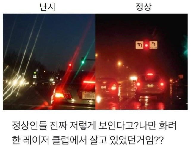 시력 좋은사람들은 절대 모를꺼야 | 인스티즈
