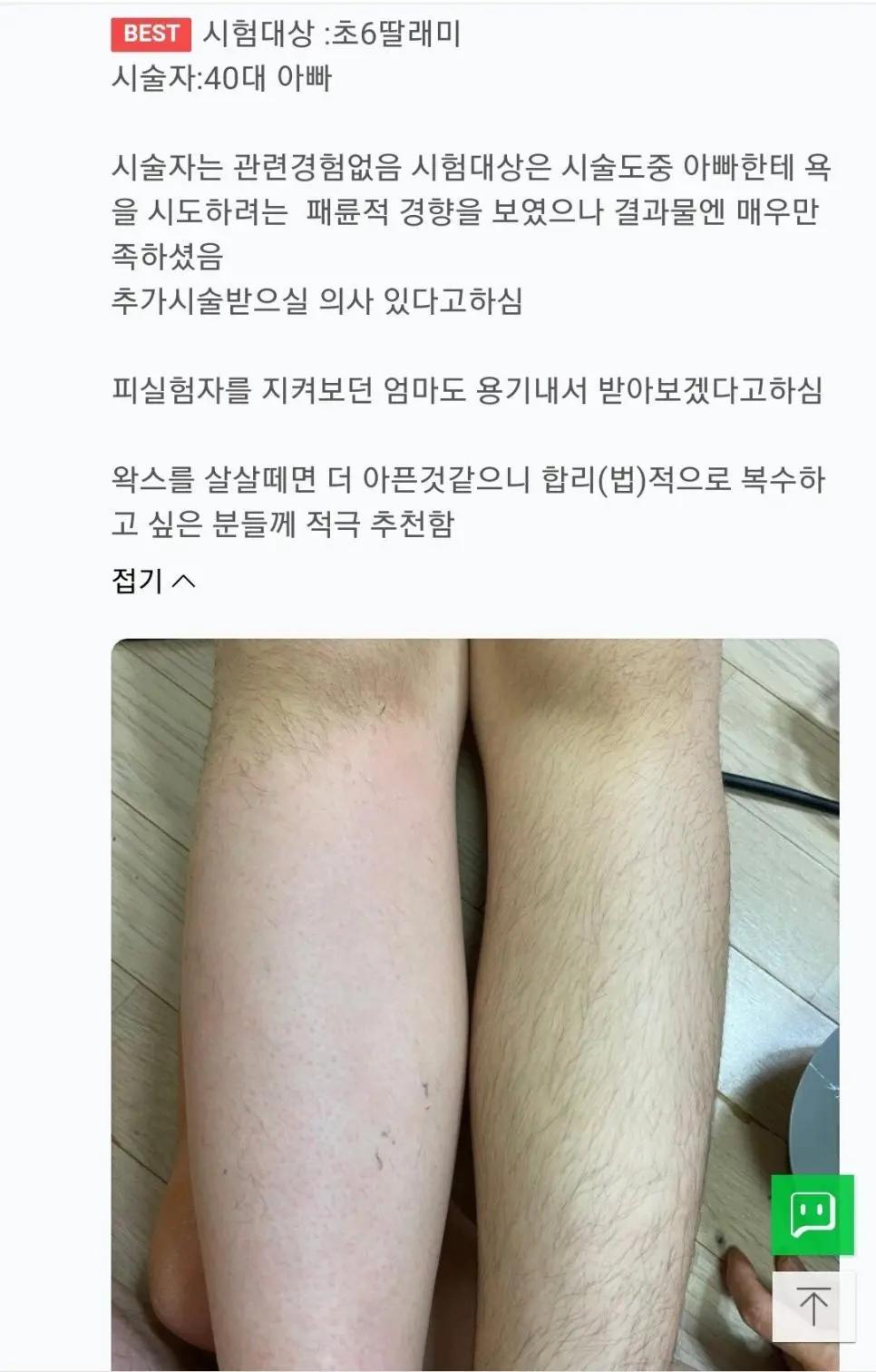 초6 딸래미 왁싱해준 40대 아빠 | 인스티즈