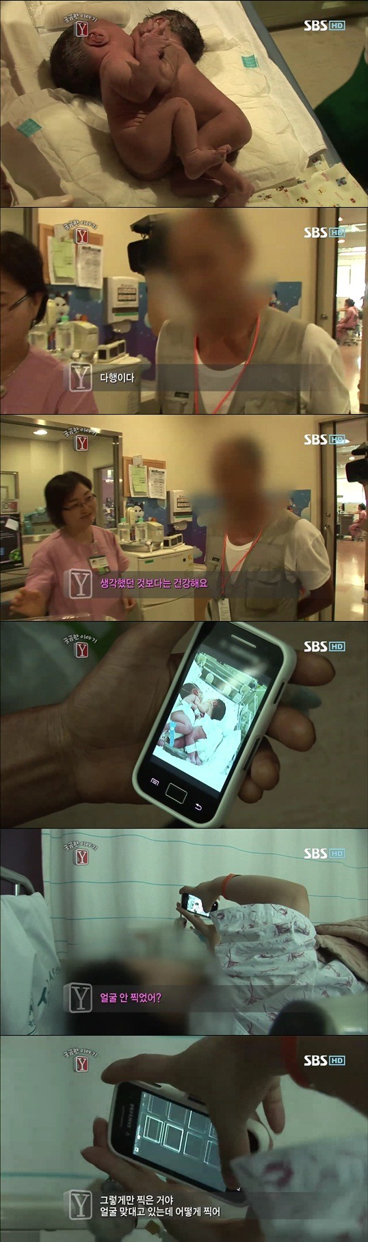 궁금한이야기 Y 샴쌍둥이 이야기 | 인스티즈
