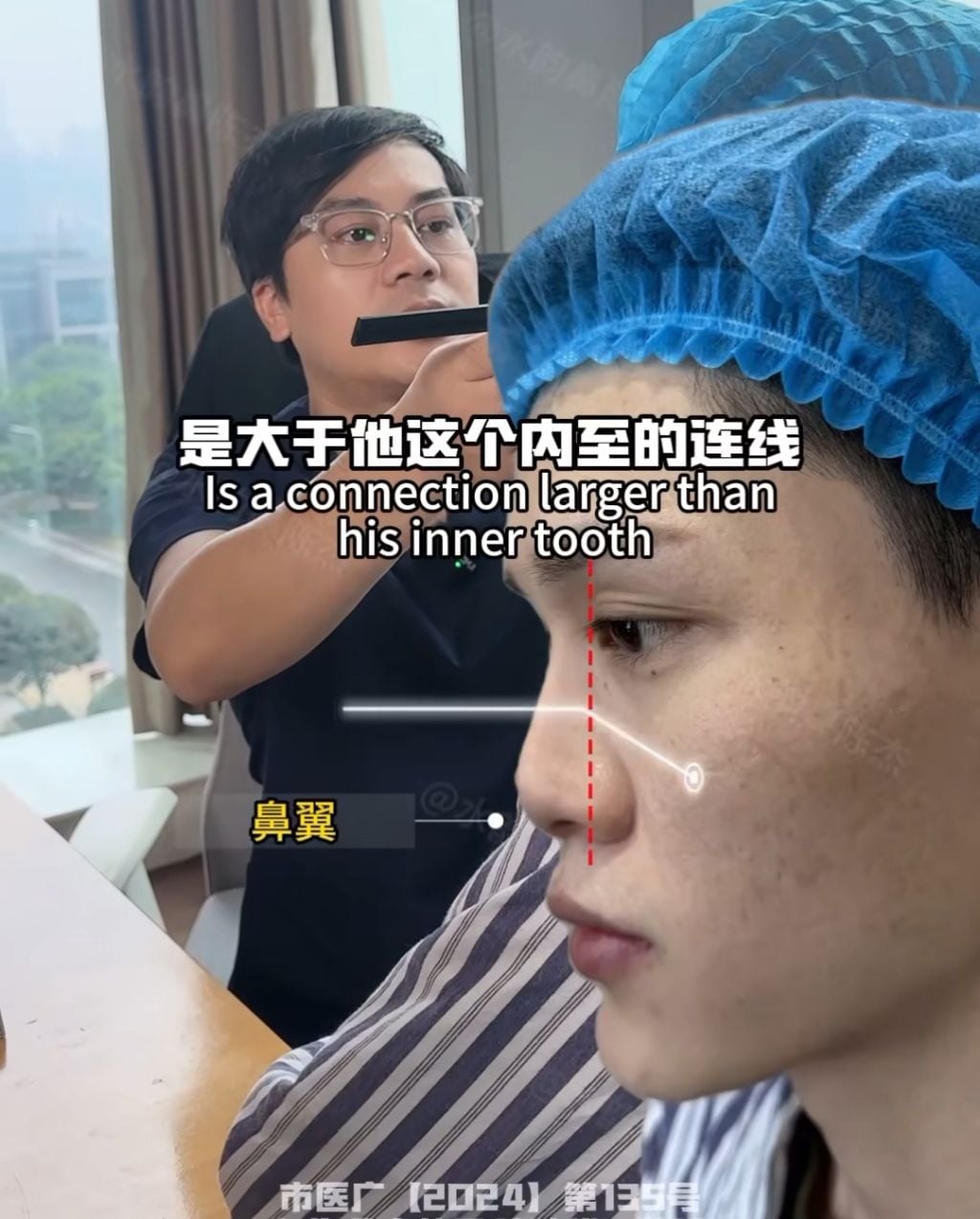 남자 코수술 레전드 | 인스티즈