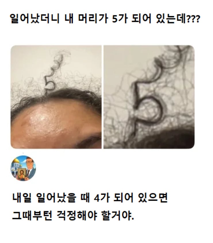 일어났더니 내 머리가 5가 되어 있는데?? | 인스티즈