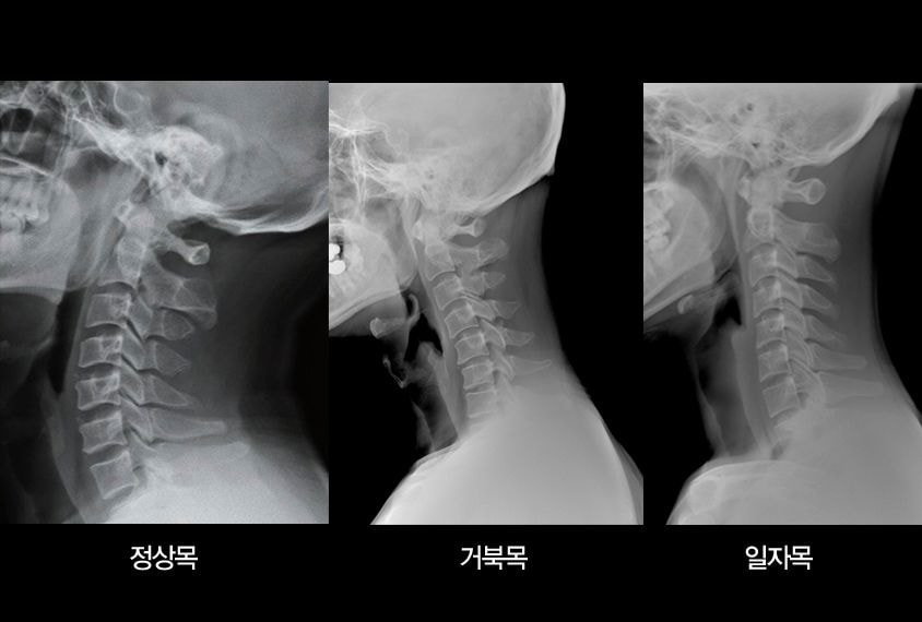맨날 북마크만 하고 까먹지 않았으면 하는 관절 다 고장나는 최악의 자세들.jpg | 인스티즈