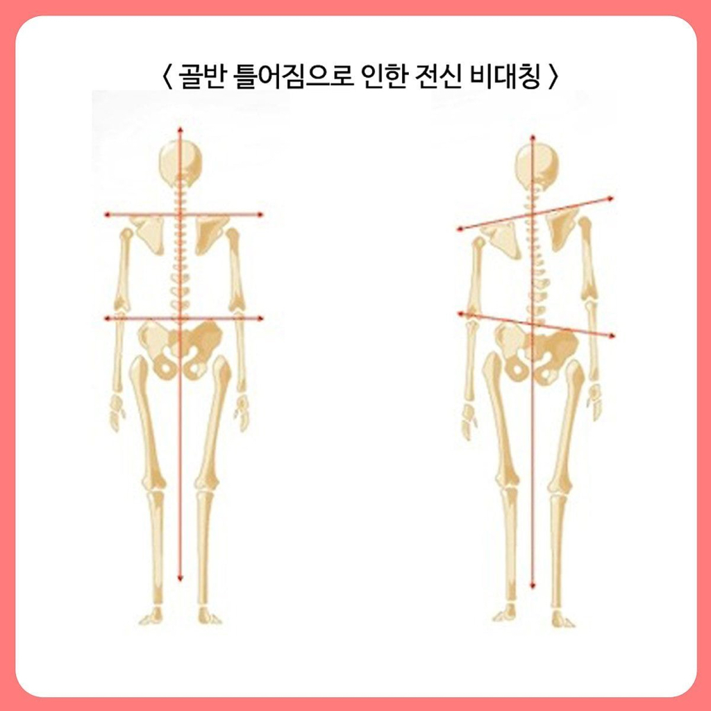 맨날 북마크만 하고 까먹지 않았으면 하는 관절 다 고장나는 최악의 자세들.jpg | 인스티즈