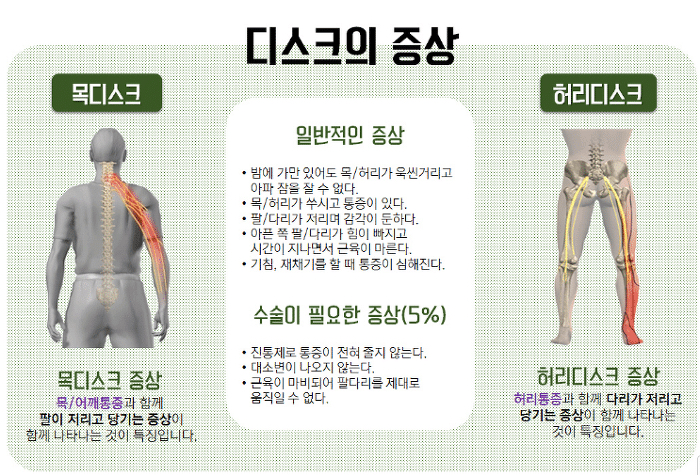 맨날 북마크만 하고 까먹지 않았으면 하는 관절 다 고장나는 최악의 자세들.jpg | 인스티즈