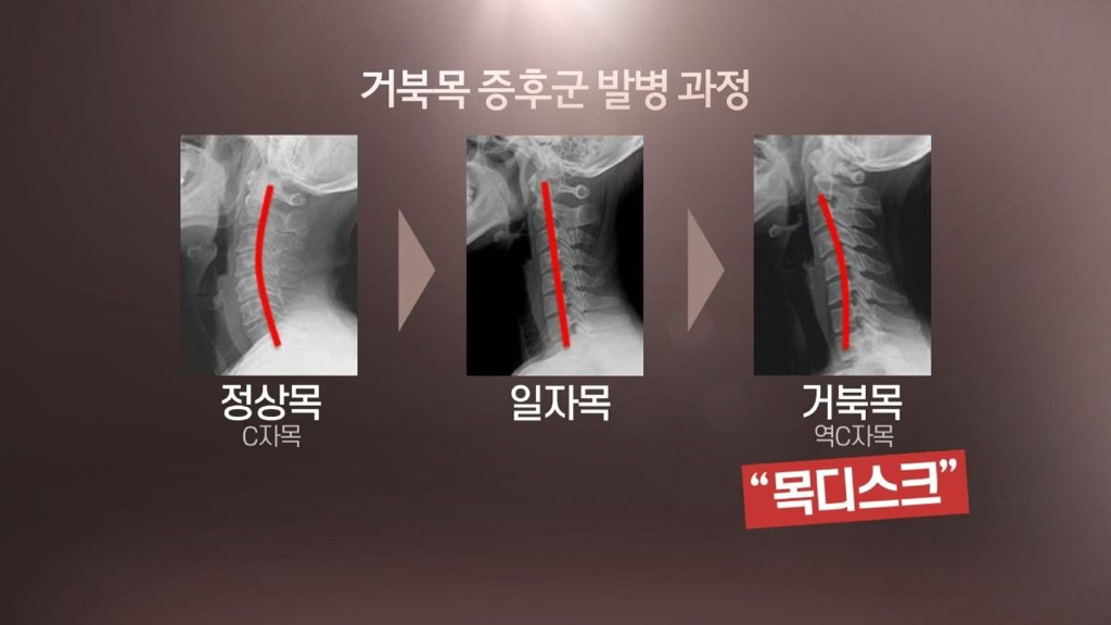 맨날 북마크만 하고 까먹지 않았으면 하는 관절 다 고장나는 최악의 자세들.jpg | 인스티즈