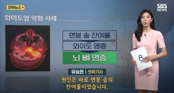 귓밥 습관적으로 파내면 안되는 이유 | 인스티즈