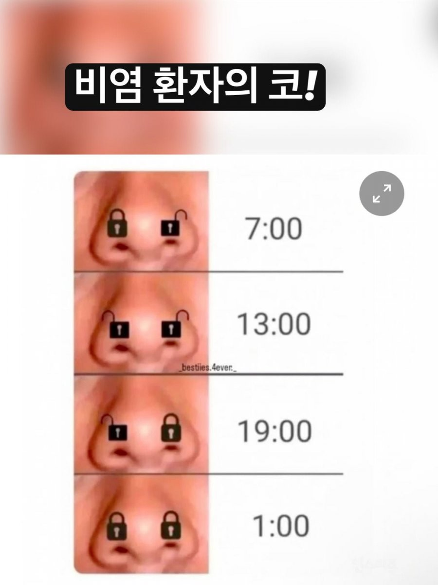 비염 환자의 코 | 인스티즈