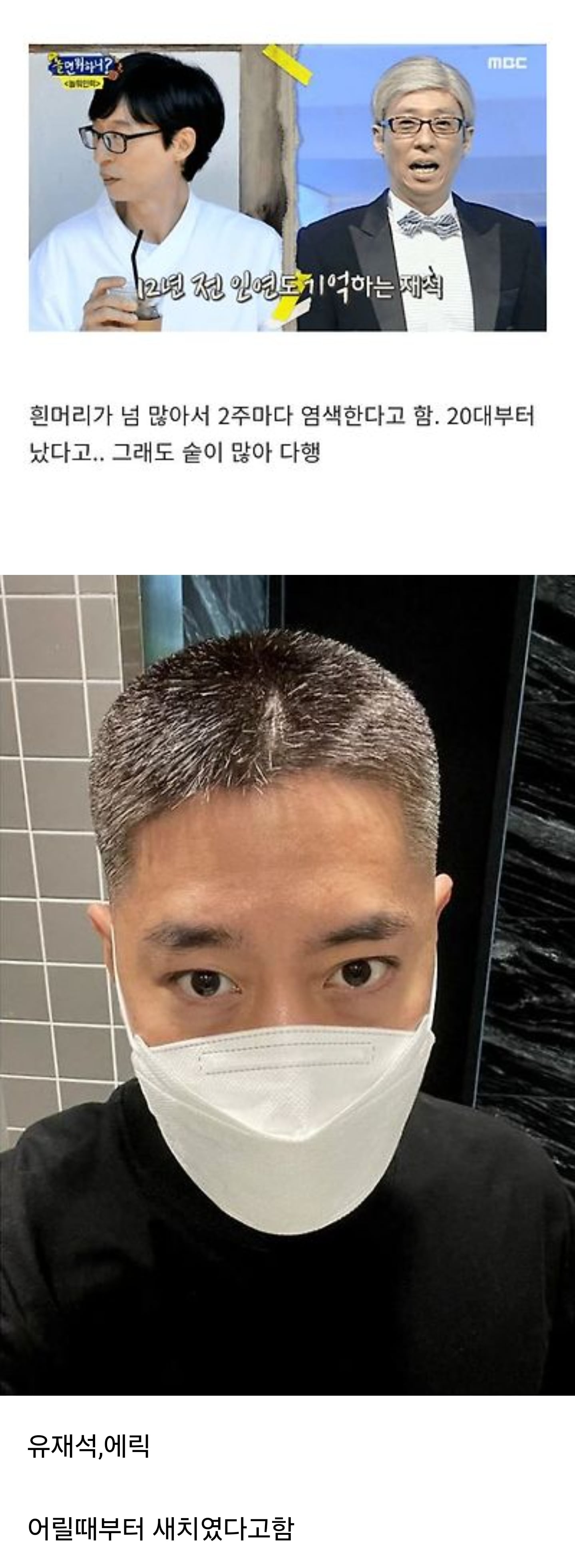 2주마다 염색한다는 모태새치 연예인 | 인스티즈
