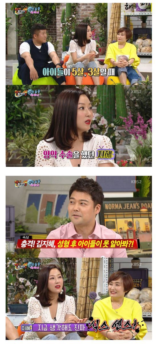 [해피투게더] 양악수술 레전드 | 인스티즈