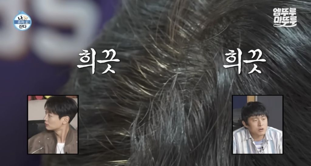 생각보다 젊은 사람들도 많다는 흰머리 | 인스티즈