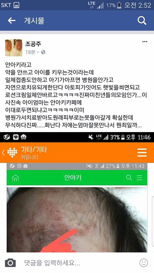아기 약 안먹이고 자연 치유 시키는 안아키 라는 카페.jpg (혐오주의) | 인스티즈