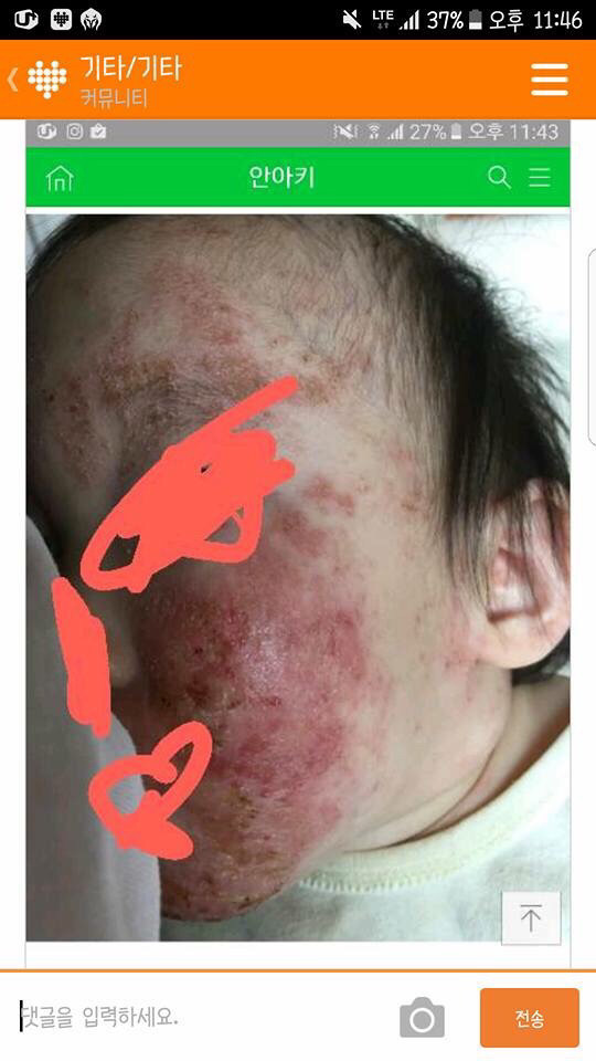 아기 약 안먹이고 자연 치유 시키는 안아키 라는 카페.jpg (혐오주의) | 인스티즈